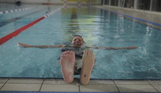 Woman with prosthetic leg in swimming pool, preparing to swim